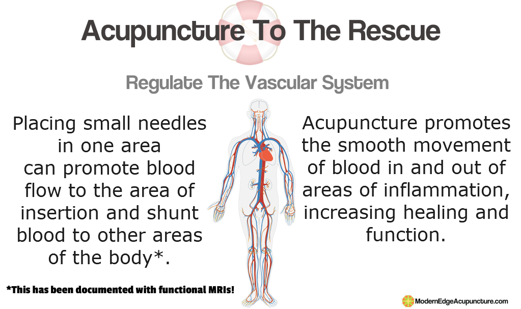 acupuncture relief